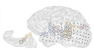 Research reveals “Tinnitus” directly linked to brain network, 1 out of 5 people affected
