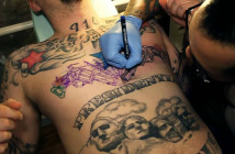 tattoo-allergy-skin-br