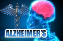 ALZHEIMER