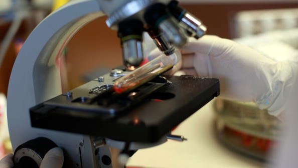 Researchers create test to detect all viruses in humans and animals